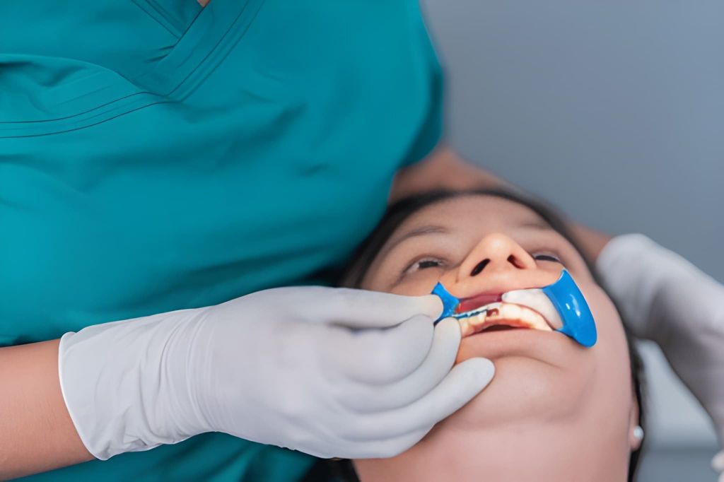 dental fillings near you