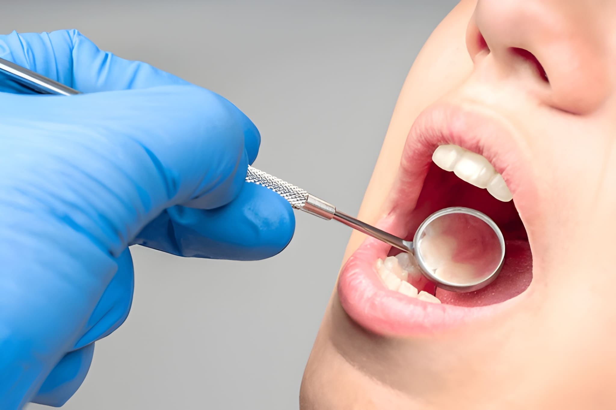 periodontal disease treatment near you